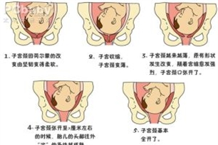 分娩的意思、造句、近义词