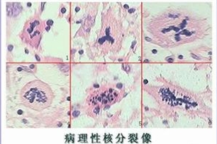 核分裂